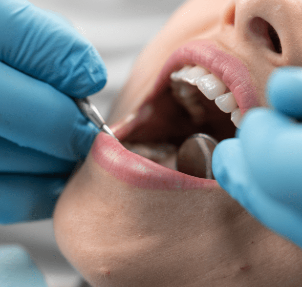 dental care burke va