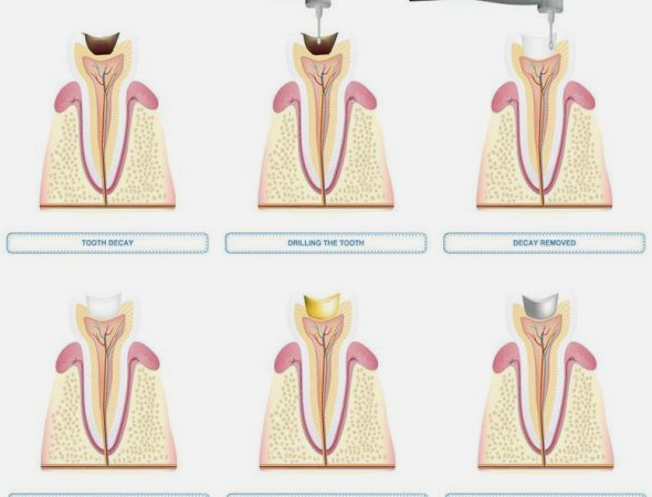 dental care burke va